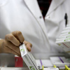 Naučnici: Ne možemo garantovati da će lijek za AIDS ikada biti pronađen