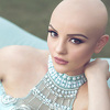 Tinejdžerka koja boluje od raka inspirisala svijet fotografijama: I dalje sam princeza