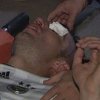 Robin van Persie u "dobrom stanju" nakon povrede oka