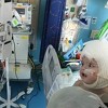 Razdvojeni sijamski blizanci iz Illinoisa prvi put ugledali jedan drugog