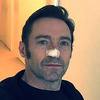 Slavni glumac Hugh Jackman ponovo boluje od raka