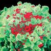 Veliki korak u borbi protiv HIV-a: Izliječeno pet osoba, istraživanje još uvijek traje