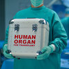 Banke organa za transplantaciju bi mogle postati stvarnost