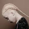 Albino blizanke iz Brazila osvojile modni svijet