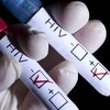 Spolno prenosive bolesti uporno se ponavljaju u BiH, porast infekcije HIV-om