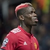 Pogba pauzira mjesec i po zbog povrede