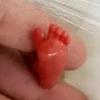 Najmanja beba u Aziji, koja je pri rođenju imala 400 grama, izborila se za život