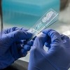 Naučnici korak bliže univerzalnom testu krvi za otkrivanje raka