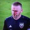 Rooney postigao prvijenac u dresu DC Uniteda pa mu nakon duela stradalo lice