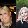 Žena smršala 158 kg i imala pet operacija, ali i dalje je ismijavaju zbog njenog izgleda