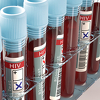 Besplatno testiranje na HIV i hepatitis u petak ispred BBI centra