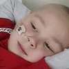 Dječak koji boluje od leukemije pisao Djeda Mrazu: Za Božić želim kovrdžavu kosu