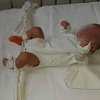 Šokantni prizori iz zagrebačke bolnice: Bebe leže u mokraći vezane za krevet