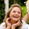Ova 14-godišnjakinja je model s Downovim sindromom: Borite se za svoje snove