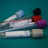 Nema reagensa, ali ni garancije povrata novca za nalaze u privatnim klinikama u Sarajevu