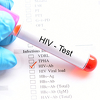 Pacijent iz Londona izliječen od HIV infekcije