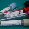 Stigli reagensi za biohemijske analize u domovima zdravlja u Sarajevu