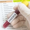 Blaga anemija može imati iznenađujuće pozitivne efekte na organizam