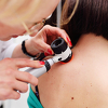 Najbolja borba protiv melanoma je redovna kontrola