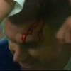 Džeko izvukao deblji kraj u duelu sa Chiellinijem: Štoper Azzurra razbio glavu kapitenu BiH