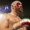 Tyson Fury krvario od treće runde, ali jednoglasnom odlukom sudija pobijedio Wallina