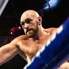 Tyson Fury objavio fotografiju svog lica nakon žestoke borbe i 47 šavova