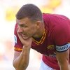 Edin Džeko uspješno operisan u Rimu, u lice mu ugrađena pločica