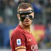 Džeko zaigrao sa zaštitnom maskom u katastrofalnoj utakmici Sampdorije i Rome