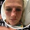 Brutalno pretučena MMA borkinja: Nisam bila spremna za napad, ovo je čista ljubomora