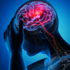 Razgovarali smo s neurologom: Kako prepoznati simptome moždanog udara i kako si pomoći