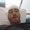 Potvrđena optužnica protiv drugog napadača na novinara Vladimira Kovačevića
