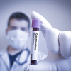 Koronavirus u RS: Trenutno 241 osoba pod zdravstvenim nadzorom