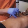 Kako nestaju tetovaže: Dermatolog otkriva detalje o popularnoj proceduri