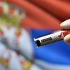 Registrovana 54 nova slučaja koronavirusa u Srbiji, vlast najavila masovno testiranje