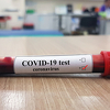 Srbijanski ministar zdravlja potvrdio da su dvije bebe pozitivne na koronavirus