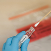 Rezultati testa na koronavirus gotovi su za 24 sata, no neke zemlje se i dalje bore za dijagnozu