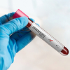 Velika Britanija će uskoro imati 15-minutni test na koronavirus koji se može raditi kući