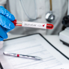 RS očekuje 25.000 testova na koronavirus i bit će potpuno besplatni