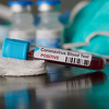 U Srbiji preminule još dvije osobe koje su bile pozitivne na koronavirus
