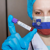 U Sloveniji 70 novih zaraza, ukupno 632 slučaja koronavirusa, osam umrlih