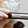 Od koronavirusa preminulo više od 30.000 ljudi, oporavilo se više od 140.000