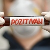 Još četiri osobe zaražene koronavirusom u Tuzlanskom kantonu, povezane s Centrom za srce