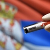 U Srbiji preminulo osam osoba pozitivnih na koronavirus, čak 305 novozaraženih