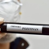 Od 22 testirana uzorka na KCUS-u samo jedan pozitivan, u SKB Mostar svih 28 negativno