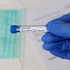 U BiH do sada testirano više od 6.300 osoba, udio pozitivnog ishoda oko 10 posto