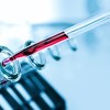 Testovi u Njemačkoj pokazali da je 14 posto ljudi već steklo imunitet na koronavirus