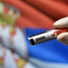 U Srbiji šest osoba preminulo usljed zaraze koronavirusom, 250 novozaraženih