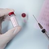 Napravljen test koji može identificirati koronavirus prije nego osoba postane zarazna