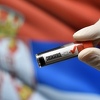 U Srbiji dvije osobe preminule, 79 novozaraženih