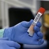 Komercijalno testiranje na koronavirus moguće i u Kliničkom centru u Tuzli, poznata i cijena